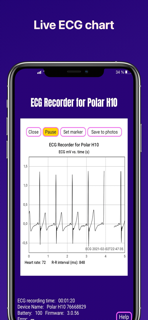 ECG Recorder chart